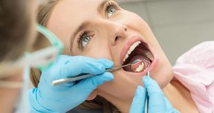 perawatan gigi scaling gigi